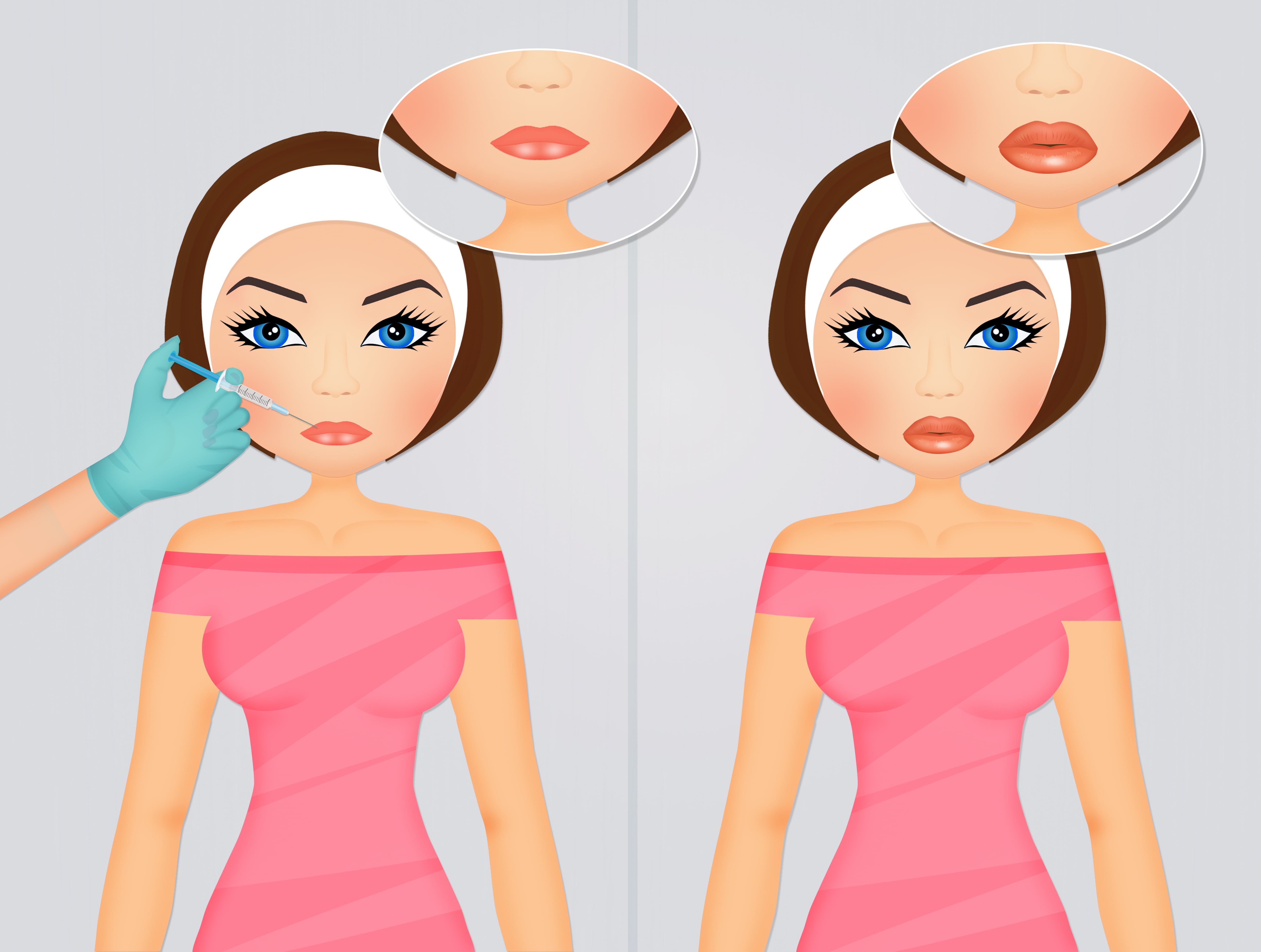 Lip Augmentation Surgery in Pune